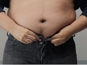 Obese Man Loses 9 Kg Within 15 Days, Thanks To Naturopathic Treatment Obese Man Loses 9 Kg Within 15 Days, Thanks To Naturopathic Treatment