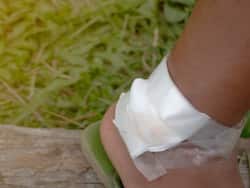 Venous Ulcer: All That One Needs To Know