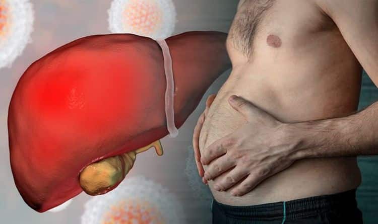 enlarged liver hepatitis