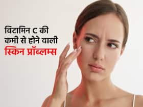 विटामिन C की कमी से चेहरे पर जल्द दिख सकती हैं झुर्रियां, ये 3 स्किन प्रॉब्लम्स भी हैं Vitamin C deficiency के लक्षण विटामिन C की कमी से चेहरे पर जल्द दिख सकती हैं झुर्रियां, ये 3 स्किन प्रॉब्लम्स भी हैं Vitamin C deficiency के लक्षण