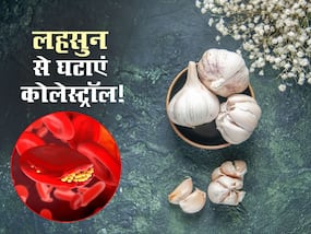 कोलेस्ट्रॉल घटाने के लिए इस तरह खाएं लहसुन, जानें तरीका और अन्य फायदे
