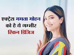 कैंसर को हराने वाली South की एक्ट्रेस ममता मोहन को है ये स्किन डिजिज, धूप पड़ते ही स्किन पर होता हैं ऐसा असर