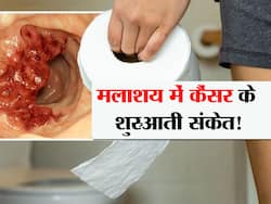 शौच के वक्त ये 3 लक्षण बताते हैं मलाश्य में कैंसर! जानें शरीर में इस जगह पर होने वाले कैंसर के शुरुआती संकेत