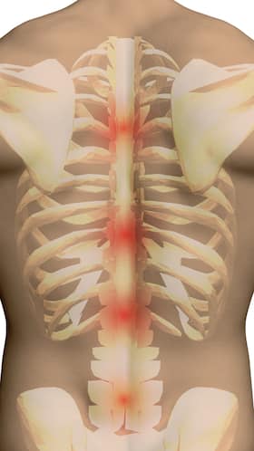Spine: An Essential Part Of The Body Spine: An Essential Part Of The Body
