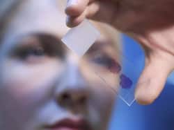 बार-बार खून की कमी Blood cancer का हो सकता है संकेत? खून के कैंसर के 4 कॉमन लक्षण जिन्हें नहीं करना चाहिए इग्नोर