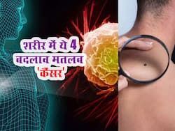शरीर में दिखाई देने वाले ये 4 बदलाव बताते हैं शरीर में घुस गया है कैंसर! डेली रूटीन में इस तरह लगाएं पता