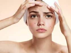 How To Treat Clogged Pores In Winter: Tips From Shahnaz Husain