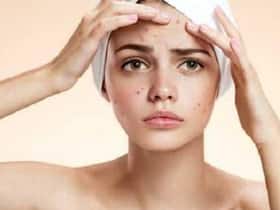 How To Treat Clogged Pores In Winter: Tips From Shahnaz Husain