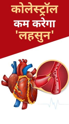 लहसुन से कम करें 'नसों' में जमा कोलेस्ट्रॉल लहसुन से कम करें 'नसों' में जमा कोलेस्ट्रॉल