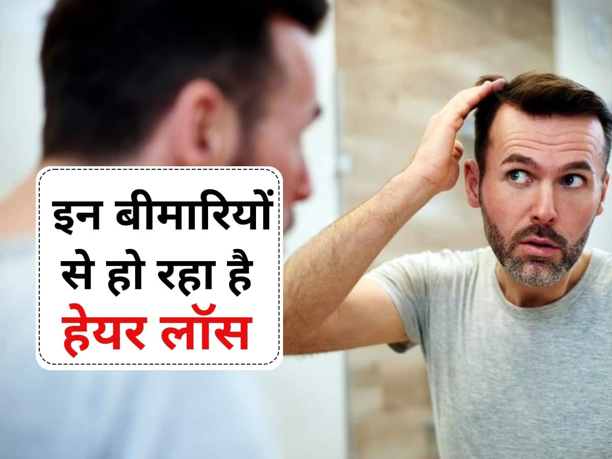 नद क कम स बल झडन क करण और अचछ नद लन क उपय  Ways To  Prevent Hair Loss Due To Lack Of Sleep In Hindi