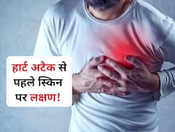 स्किन पर दिखाई देने वाले ये बदलाव बताते हैं आने वाले है Heart attack, जानें पुरुषों और महिलाओं में अलग-अलग संकेत