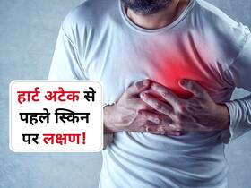 स्किन पर दिखाई देने वाले ये बदलाव बताते हैं आने वाले है Heart attack, जानें पुरुषों और महिलाओं में अलग-अलग संकेत