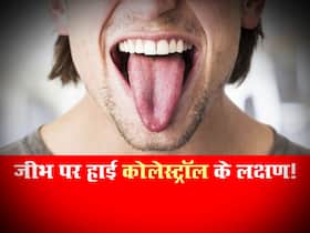 नसों में कोलेस्ट्रॉल भर जाने पर जीभ का रंग हो जाता है ऐसा! जानें High cholesterol में जीभ पर दिखने वाले 2 लक्षण