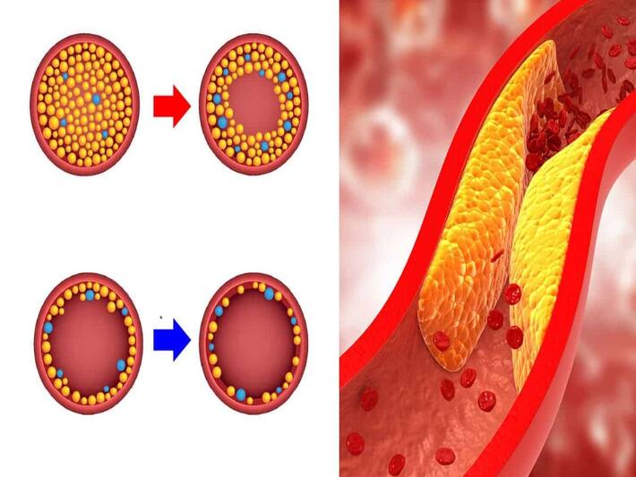 Ghee in High Cholesterol High Cholesterol में भूलकर भी न खाएं ये वाला