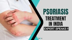 Skin Condition Psoriasis: Know How Buildup Cells Cause Psoriasis, What Treatment Can Be Given, Expert Speaks, Watch Video