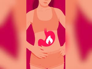 7 Tips To Get Rid Of Acid Reflux In Winter Season