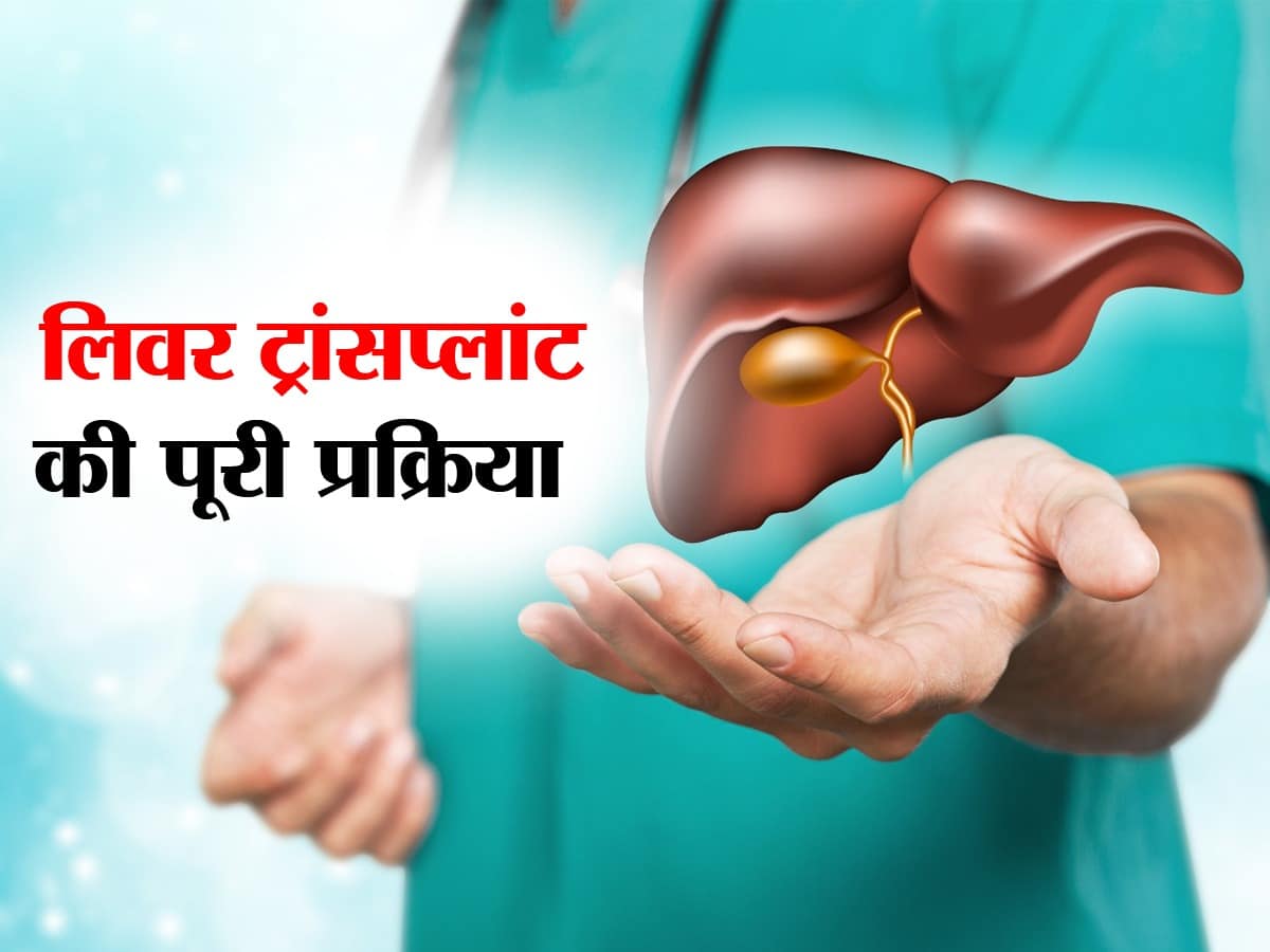 Liver Transplant in Hindi लिवर ट्रांसप्‍लांट क्‍या है इसकी आवश्‍यकता