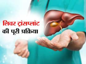 लिवर ट्रांसप्‍लांट की आवश्‍यकता कब पड़ती है, एक्सपर्ट से जानिए क्‍या है इसकी प्रक्रिया