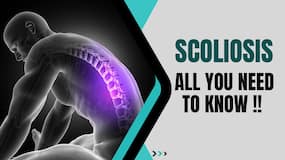 Scoliosis: Why Children Are Most Commonly Diagnosed With Scoliosis, All You Need To Know About The Condition !! Watch Video