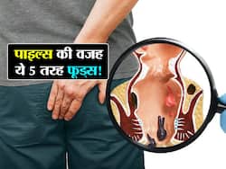 इन 5 तरह के फूड्स को खाने से पाइल्स में आता है खून! जानें कौन से फूड्स खाने से मल के साथ निकलता है खून