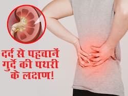 Kidney Stone Symptoms : किडनी में पथरी होने पर लंबे अरसे तक नहीं दिखते ये 4 लक्षण! इस तरह पहचानें गुर्दे में हो गई है पथरी