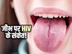 जीभ पर दिखाई देने वाले ये लक्षण देते हैं HIV का संकेत! इस तरह पहचानें क्या आपको भी हुई ये खतरनाक बीमारी