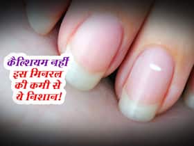 कैल्शियम नहीं बल्कि शरीर में इस मिनरल की कमी से होते हैं नाखून पर सफेद दाग! जानें कौन से फूड्स करेंगे कमी दूर