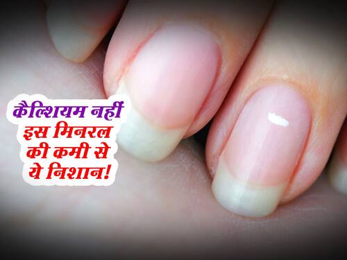 White spot on Nails : कैल्शियम नहीं बल्कि शरीर में इस मिनरल की कमी से होते  हैं नाखून पर सफेद दाग!  हिंदी