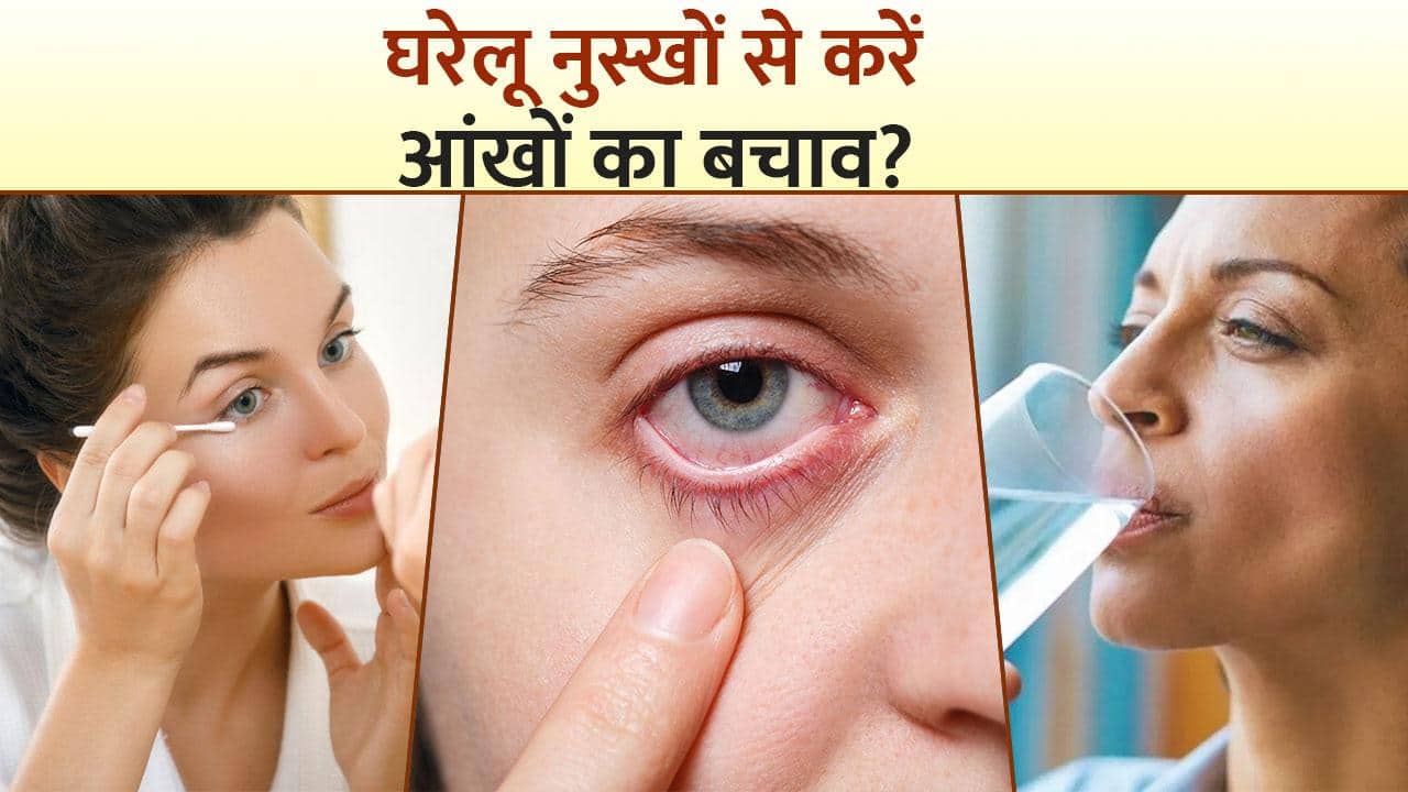 आंखों की इन परेशानियों ना करें नजरअंदाज, घरेलू नुस्खों से करें बचाव