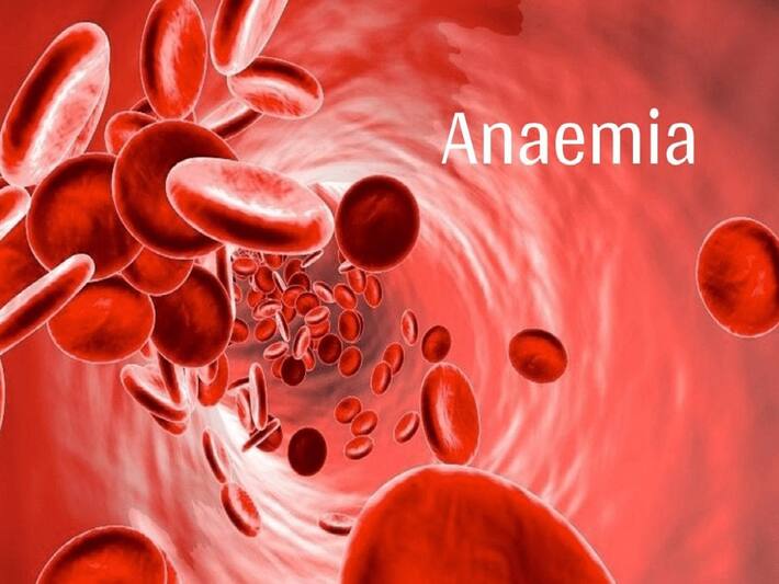 Iron Deficiency Anemia Warning Symptoms You Should Never Ignore 8826