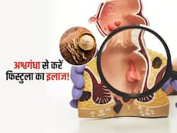 फिस्टुला की नेचुरल दवा है अश्वगंधा, सही तरह सेवन किया तो सर्जरी की जरूरत नहीं पड़ेगी