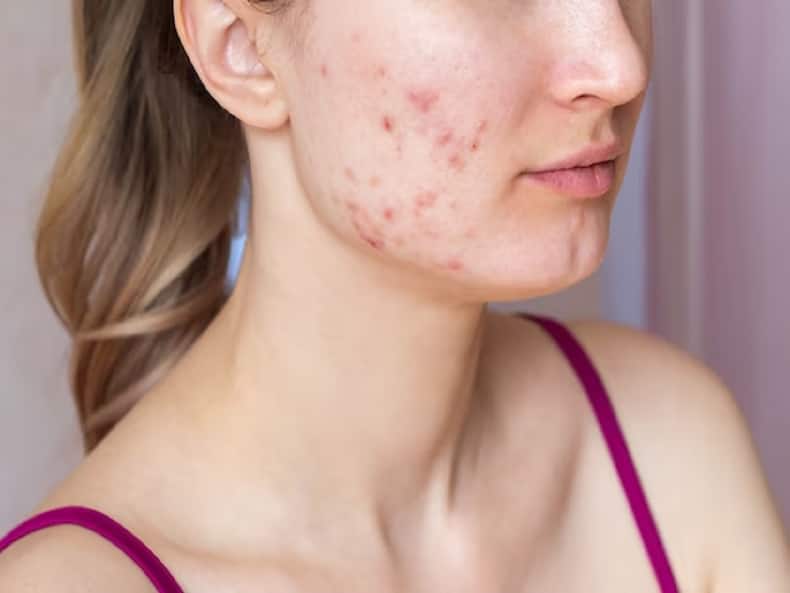 thehealthsite.com top news