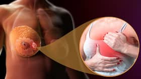 1.6 Kg Tumour Removed From Woman's Breast: How Doctors Gave 42-Year Breast Cancer Patient A New Lease of Life