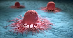 ICMR Reveals Most Common Cancers Among Delhi's Men And Women: Check Them Out