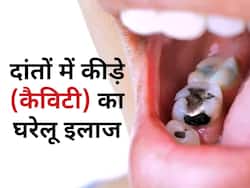 दांतों में काले कीड़ों को बाहर कर दर्द को दूर करते हैं ये 5 घरेलू उपचार, जानिए प्रयोग का तरीका  