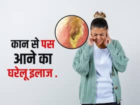 कान में दर्द के साथ-साथ निकल रहा है पस? इन आसान से घरेलू उपायों से मवाद से मिलेगा छुटकारा कान में दर्द के साथ-साथ निकल रहा है पस? इन आसान से घरेलू उपायों से मवाद से मिलेगा छुटकारा