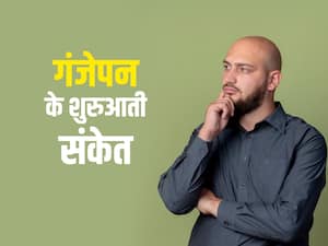 आपके बालों में ये 4 बदलाव गंजेपन की है निशानी, जानिए गंजेपन के शुरुआती संकेत आपके बालों में ये 4 बदलाव गंजेपन की है निशानी, जानिए गंजेपन के शुरुआती संकेत