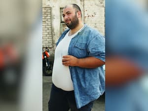 Are You Having A Hormonal Belly? See The Signs