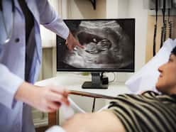 Are Babies Born From Frozen Embryo Transfer (FET) Healthy?