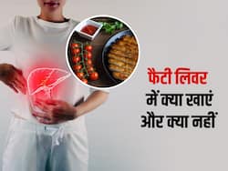 फैटी लिवर नहीं हो रहा ठीक? आज से ही खाएं ये 5 फूड्स, कम होगी लिवर की सूजन