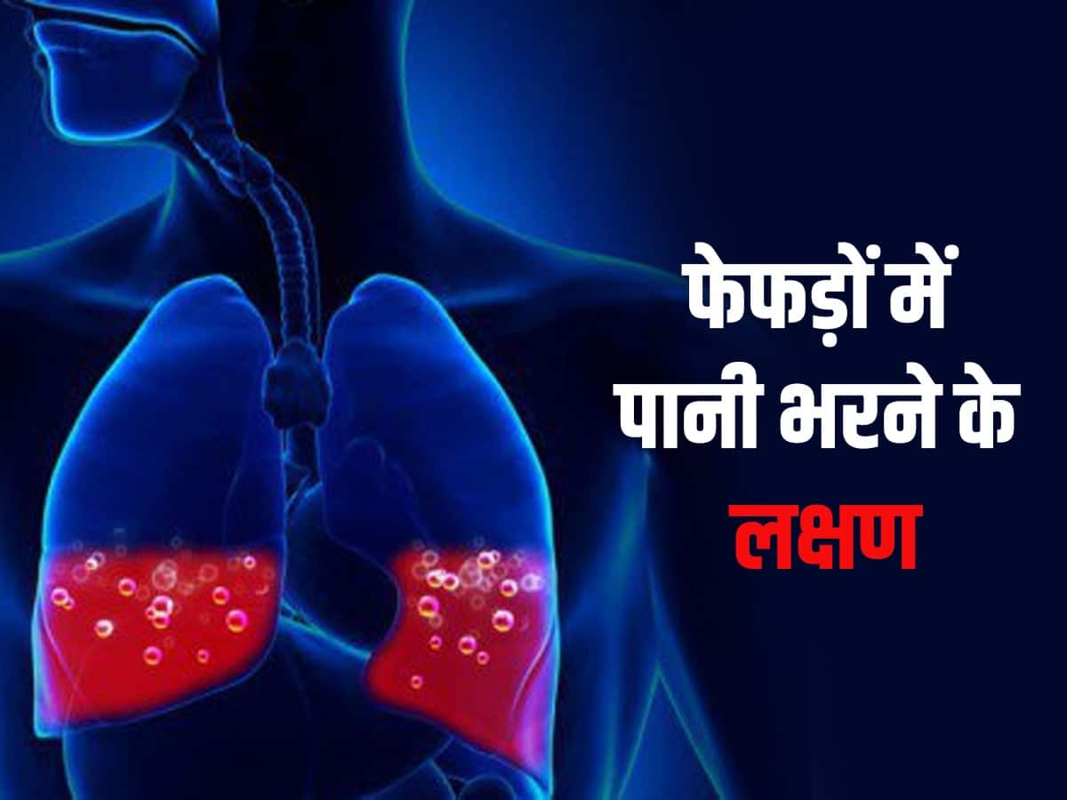 Fefdo Mein Pani Bharna Lakshan Pulmonary Edema फेफड़ों में पानी