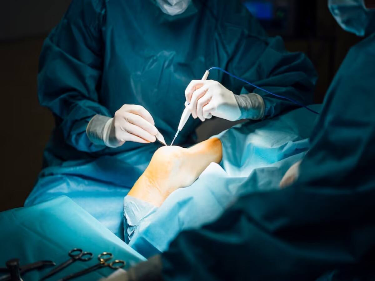 The Right Time To Get A Joint Replacement Surgery