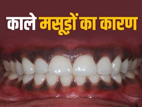 Masudo Ka Kalapan: मसूड़ों के कालेपन से न हो शर्मिंदा, इन 5 सस्ते नुस्खों से चमक जाएंगे मसूड़े Masudo Ka Kalapan: मसूड़ों के कालेपन से न हो शर्मिंदा, इन 5 सस्ते नुस्खों से चमक जाएंगे मसूड़े