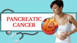 Pancreatic Cancer: Importance Of Early Detection And Treatment
