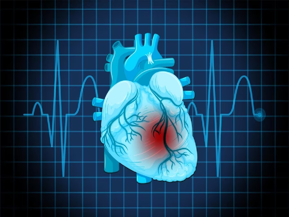 Heart Arrhythmia: 8 Signs Of Heart Illness Induced By Irregular Heartbeats