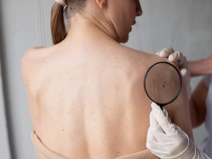 thehealthsite.com top news
