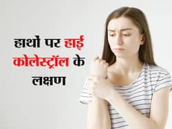 हाई कोलेस्ट्रॉल में हाथों-पैरों में होता है ऐसा, इस तरह की तकलीफों से परेशान हो जाते हैं मरीज