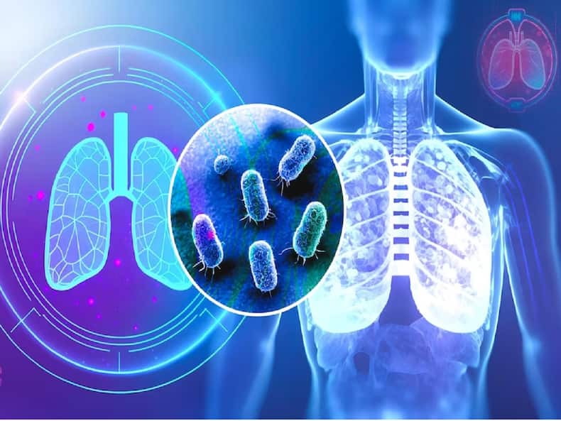 World Tuberculosis Day: Know The Impact Of TB On Vulnerable Populations
