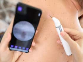 Skin Cancer On The Rise Among Younger Adults, Dermatologists Urge For Protection