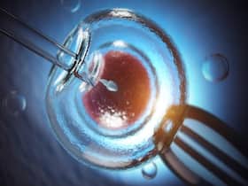 Sperm Extraction For IVF/ICSI: Various Sperm Retrieval Techniques And When They Are Used